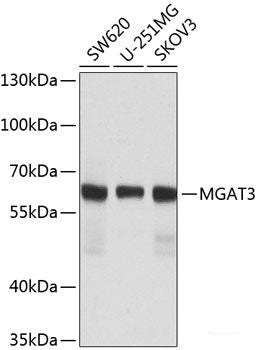 Immunofluorescence analysis of Rat oophoroma cells using ZP3 Polyclonal Antibody at dilution of  1:100. Blue: DAPI for nuclear staining.