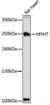 Immunohistochemistry of paraffin-embedded Rat heart using PDE4DIP Polyclonal Antibody at dilution of  1:100 (40x lens).
