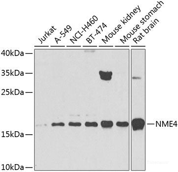 Immunohistochemistry of paraffin-embedded Mouse heart using PIK3C2A Polyclonal Antibody at dilution of  1:100 (40x lens).