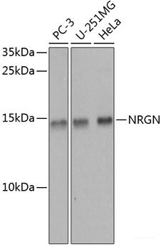 Immunohistochemistry of paraffin-embedded Rat ovary using NMT1 Polyclonal Antibody at dilution of  1:100 (40x lens).