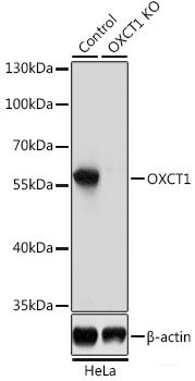Immunohistochemistry of paraffin-embedded Human liver using PPP4R1 Polyclonal Antibody at dilution of  1:100 (40x lens).