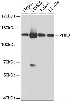 Immunofluorescence analysis of U2OS cells using NLRP2 Polyclonal Antibody at dilution of  1:100. Blue: DAPI for nuclear staining.