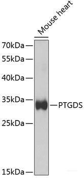 Immunohistochemistry of paraffin-embedded Rat liver using IKK alpha Polyclonal Antibody at dilution of  1:100 (40x lens).