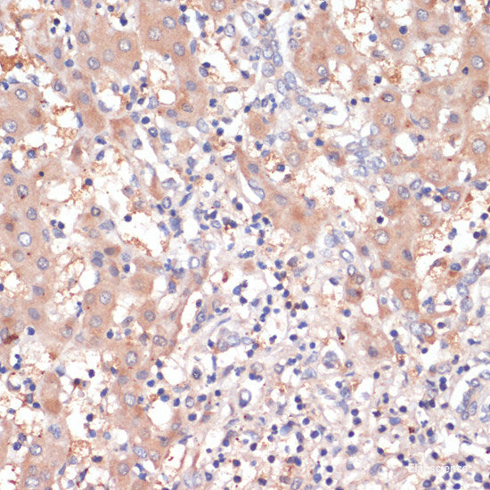Immunofluorescence analysis of HeLa cells using CDK11B Polyclonal Antibody at dilution of  1:100. Blue: DAPI for nuclear staining.