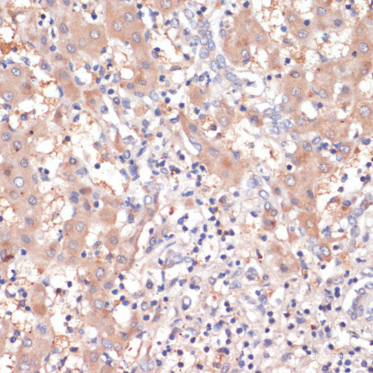 Immunofluorescence analysis of HeLa cells using CDK11B Polyclonal Antibody at dilution of  1:100. Blue: DAPI for nuclear staining.