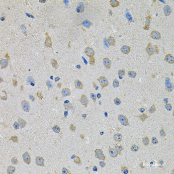 Immunohistochemistry of paraffin-embedded Rat lung using Phospho-STAT1(S727) Polyclonal Antibody at dilution of  1:100 (40x lens).
