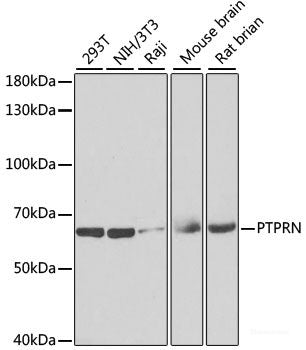 Immunohistochemistry of paraffin-embedded Rat testis using CIRBP Polyclonal Antibody at dilution of  1:100 (40x lens).