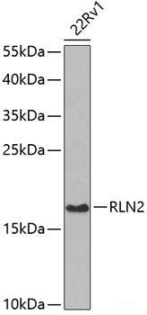 Immunohistochemistry of paraffin-embedded Rat brain using METTL13 Polyclonal Antibody at dilution of  1:100 (40x lens).