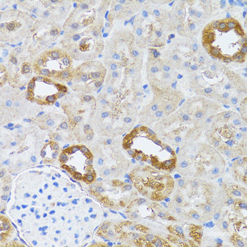 Western blot analysis of extracts of C2C12 cells using Phospho-PRKAA1(T183）/PRKAA2（T172） Polyclonal Antibody at dilution of 1:2000. C2C12 cells were treated by Oligomycin (0. 5uM) for 30 minutes, treated by serum-starvation overnight, treated by Hydrogen Peroxide (2nM) for 15 minutes or treated by AICAR (0. 5mM) for 30 minutes after serum-starvation overnight.