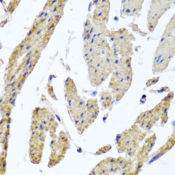 Immunohistochemistry of paraffin-embedded Human stomach using PCDHA12 Polyclonal Antibody at dilution of  1:100 (40x lens).