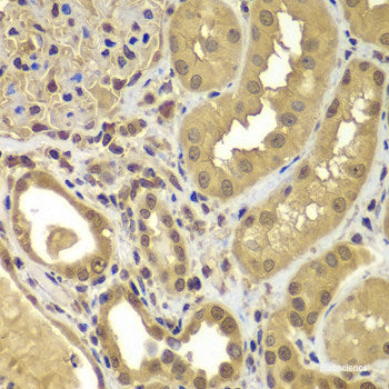 Immunohistochemistry of paraffin-embedded Mouse kidney using MAS1 Polyclonal Antibody at dilution of  1:100 (40x lens).