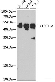 Immunofluorescence analysis of C6 cells using RPL23 Polyclonal Antibody at dilution of  1:100. Blue: DAPI for nuclear staining.