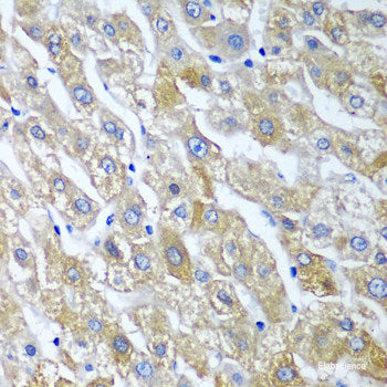 Immunohistochemistry of paraffin-embedded Human liver using UBE2U Polyclonal Antibody at dilution of  1:100 (40x lens).