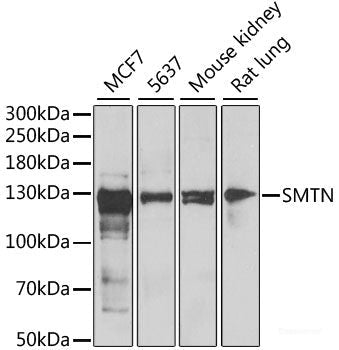 Immunohistochemistry of paraffin-embedded Human liver damage using SRGN Polyclonal Antibody at dilution of  1:200 (40x lens).