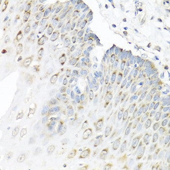 Immunohistochemistry of paraffin-embedded Human stomach using MRPL1 Polyclonal Antibody at dilution of  1:100 (40x lens).