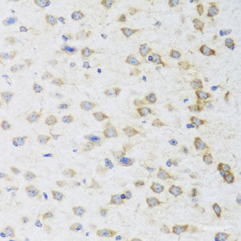 Immunofluorescence analysis of U2OS cells using KIF11 Polyclonal Antibody at dilution of  1:100. Blue: DAPI for nuclear staining.