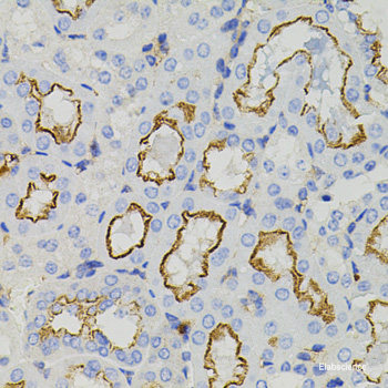 Immunofluorescence analysis of U2OS cells using NPR3 Polyclonal Antibody at dilution of  1:100. Blue: DAPI for nuclear staining.