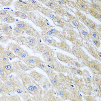 Immunohistochemistry of paraffin-embedded Human liver damage using RAB24 Polyclonal Antibody at dilution of  1:100 (40x lens).