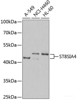 Immunohistochemistry of paraffin-embedded Rat kidney using RARRES2 Polyclonal Antibody at dilution of  1:200 (40x lens).