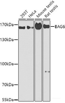 Immunohistochemistry of paraffin-embedded Human liver damage using CFH Polyclonal Antibody at dilution of  1:200 (40x lens).