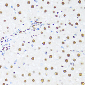 Immunohistochemistry of paraffin-embedded Mouse leydig cells using AMH Polyclonal Antibody at dilution of  1:100 (40x lens).