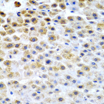 Immunohistochemistry of paraffin-embedded Human prostate using SPINT1 Polyclonal Antibody at dilution of  1:100 (40x lens).