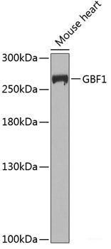 Confocal immunofluorescence analysis of U2OS cells using ARL8B Polyclonal Antibody at dilution of  1:100. Blue: DAPI for nuclear staining.