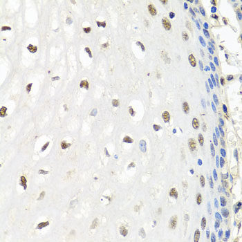 Immunohistochemistry of paraffin-embedded Mouse lung using DCP2 Polyclonal Antibody at dilution of  1:100 (40x lens).