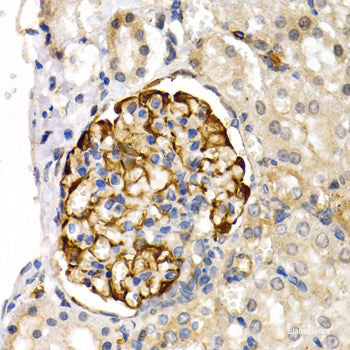 Immunohistochemistry of paraffin-embedded Human normal breast using TOR1A Polyclonal Antibody at dilution of  1:200 (40x lens).