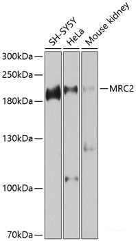 Immunohistochemistry of paraffin-embedded Human breast carcinoma using Phospho-Estrogen Receptor alpha（S118） Polyclonal Antibody