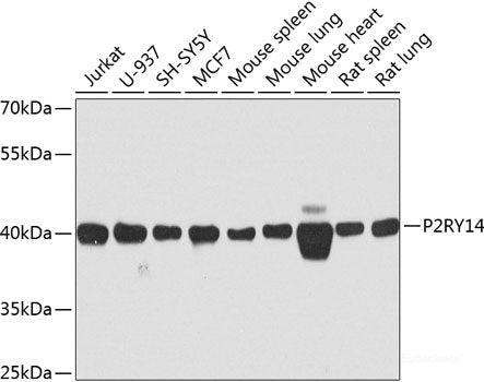 Immunohistochemistry of paraffin-embedded Rat spleen using CR2 Polyclonal Antibody at dilution of  1:100 (40x lens).