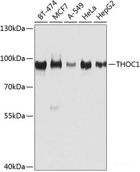 Immunohistochemistry of paraffin-embedded Rat brain using CRHR1 Polyclonal Antibody at dilution of  1:100 (40x lens).