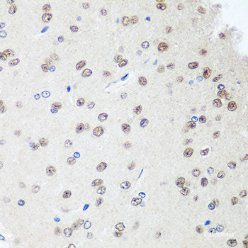 Immunohistochemistry of paraffin-embedded Rat testis using CCNG1 Polyclonal Antibody at dilution of  1:100 (40x lens).