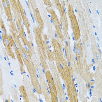 Immunohistochemistry of paraffin-embedded Human prostate using STK3 Polyclonal Antibody at dilution of  1:100 (40x lens).