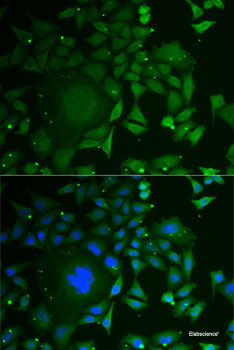 Immunohistochemistry of paraffin-embedded Rat heart using GPLD1 Polyclonal Antibody at dilution of  1:100 (40x lens).