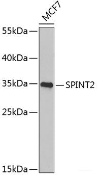 Immunohistochemistry of paraffin-embedded Rat heart using MAP2K5 Polyclonal Antibody at dilution of  1:100 (40x lens).