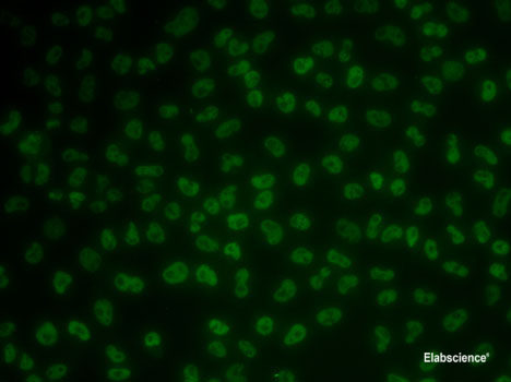 Immunohistochemistry of paraffin-embedded Rat heart using WFDC2 Polyclonal Antibody at dilution of  1:100 (40x lens).