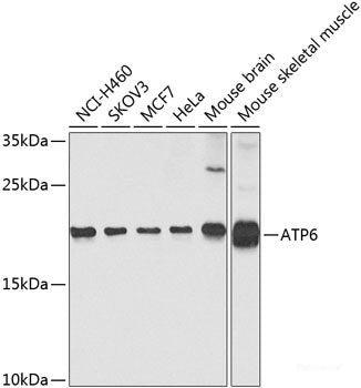 Immunohistochemistry of paraffin-embedded Rat brain using EPHA3 Polyclonal Antibody at dilution of  1:100 (40x lens).