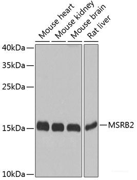Immunofluorescence analysis of 293T cells using HNRPH3 Polyclonal Antibody at dilution of  1:100 (40x lens). Blue: DAPI for nuclear staining.