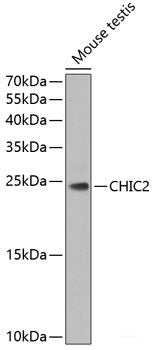 Immunohistochemistry of paraffin-embedded Rat spleen using SLC25A11 Polyclonal Antibody at dilution of  1:100 (40x lens).