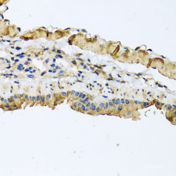 Immunohistochemistry of paraffin-embedded Human liver damage using RHOB Polyclonal Antibody at dilution of  1:100 (40x lens).
