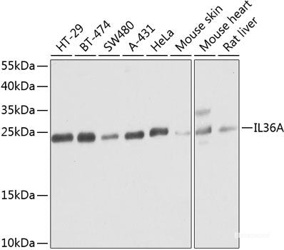 Immunohistochemistry of paraffin-embedded Mouse heart using HBA2 Polyclonal Antibody at dilution of  1:100 (40x lens).