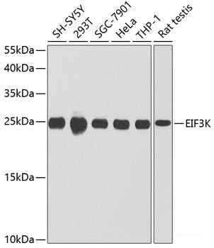 Immunohistochemistry of paraffin-embedded Human breast carcinoma tissue, using Phospho-JAK2(Y221) Polyclonal Antibody