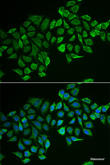 Immunohistochemistry of paraffin-embedded Human liver using IL20 Polyclonal Antibody at dilution of  1:100 (40x lens).