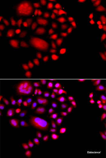 Immunofluorescence analysis of U2OS cells using ALOXE3 Polyclonal Antibody at dilution of  1:100. Blue: DAPI for nuclear staining.
