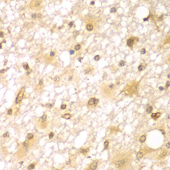 Immunofluorescence analysis of U2OS cells using SLC12A6 Polyclonal Antibody at dilution of  1:100. Blue: DAPI for nuclear staining.