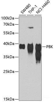 Immunohistochemistry of paraffin-embedded Rat liver using CUL4B Polyclonal Antibody at dilution of  1:200 (40x lens).