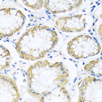 Confocal immunofluorescence analysis of U2OS cells using EBNA1BP2 Polyclonal Antibody at dilution of  1:200. Blue: DAPI for nuclear staining.