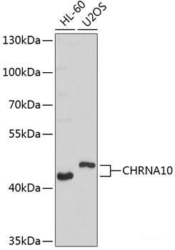 Western blot analysis of extracts of various cell lines using PLS3 Polyclonal Antibody at dilution of 1:1000.