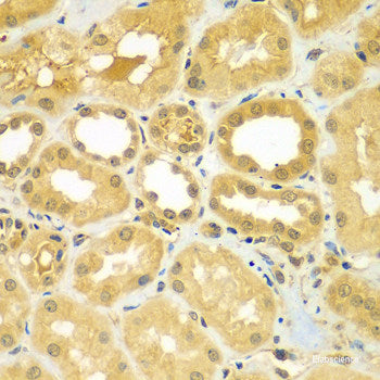 Immunofluorescence analysis of U2OS cells using AKR7A3 Polyclonal Antibody at dilution of  1:100. Blue: DAPI for nuclear staining.
